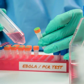 OMS alerta: surto de Ebola pode ser até quatro vezes maior na África Central